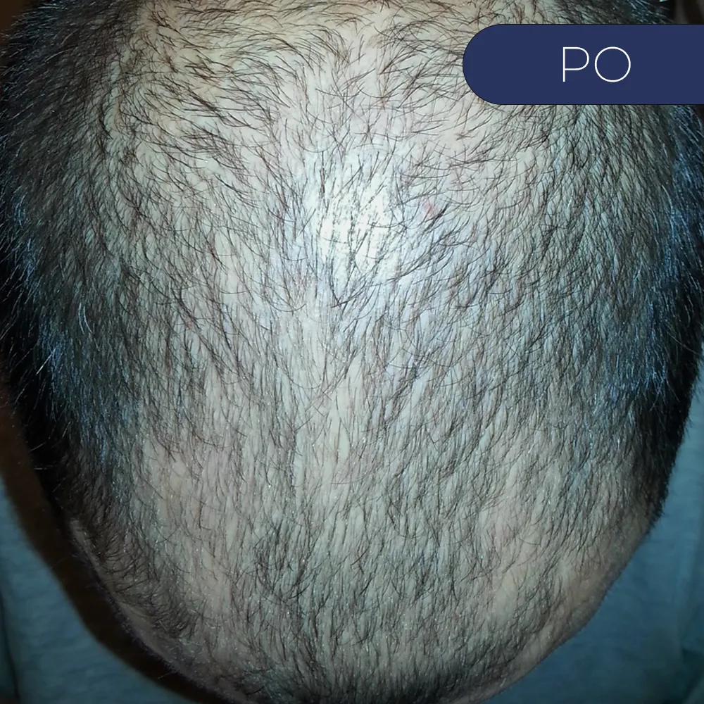Before image