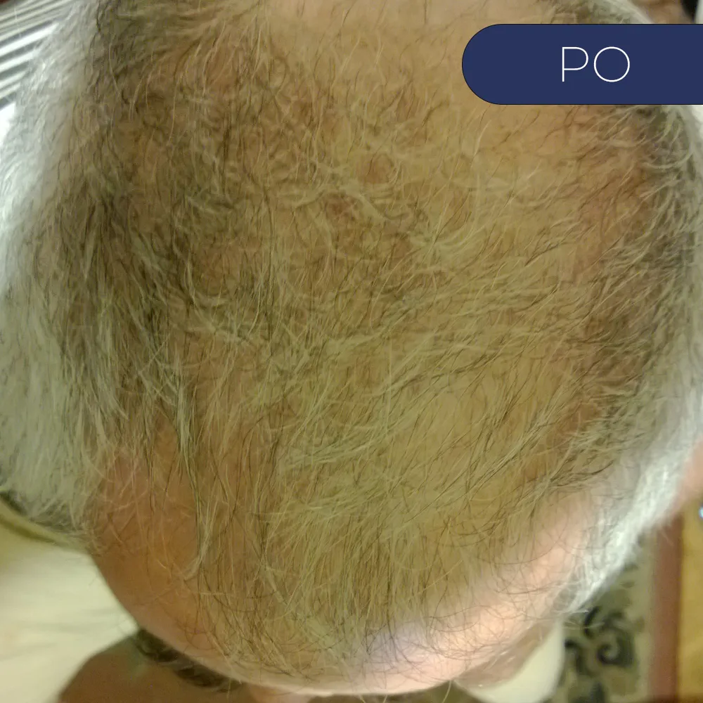 Before image