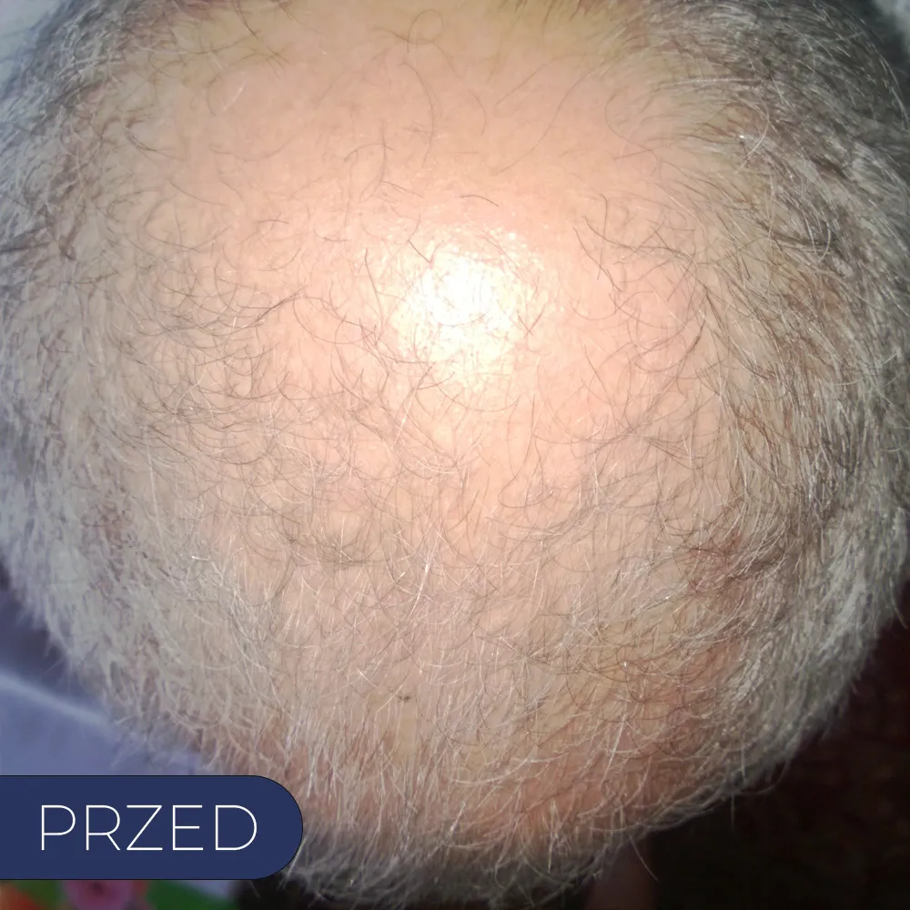 After image