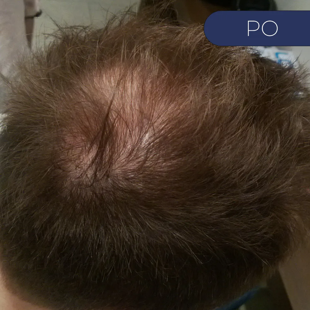 Before image