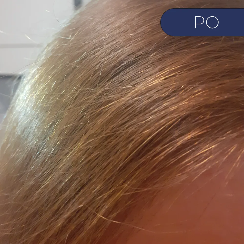 Before image